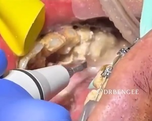 まとめ-総合記事2026030522220000